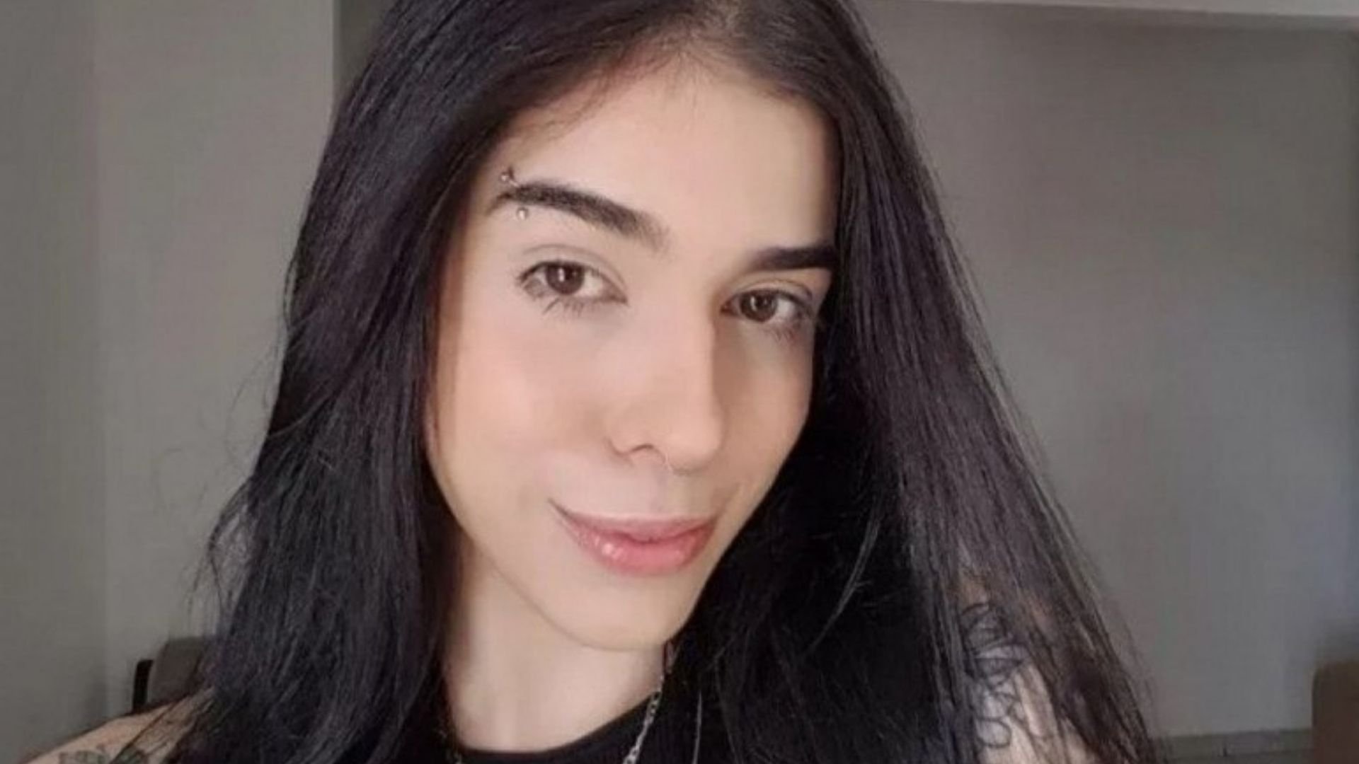 A Gazeta Jovem Que Teve Alergia Ao Cheirar Pimenta Tem Piora No