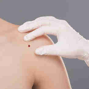 Imagem - Aluno da Ufes ganha prêmio por software de diagnóstico de câncer de pele