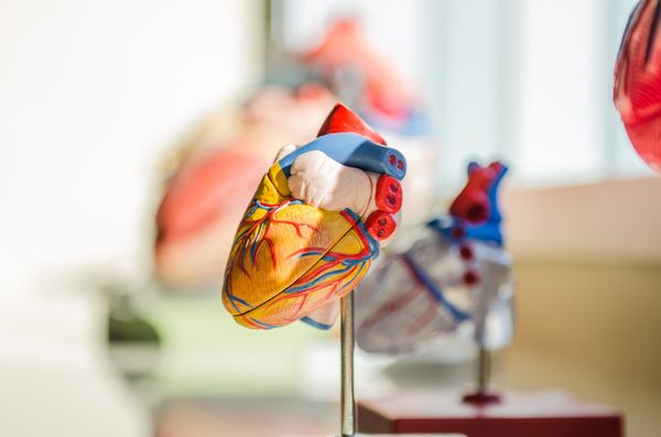 Entenda a diferença entre isquemia e infarto