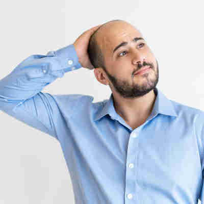 Imagem - Transplante capilar: fios e autoestima de volta