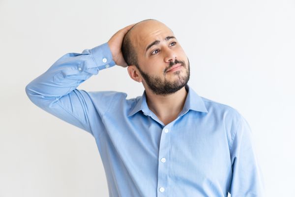 Homem com problema de calvície: transplante capilar é uma das opções. Crédito: Freepik