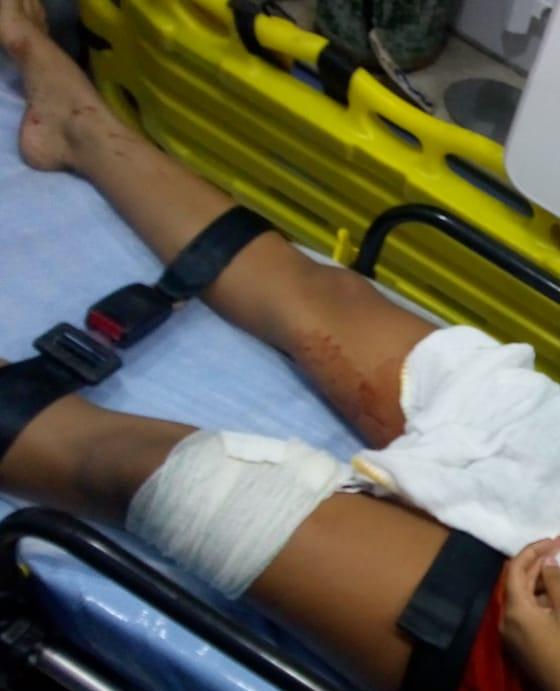 Menina de 11 anos ficou ferida ao ser baleada na Serra. Crédito: Acervo pessoal