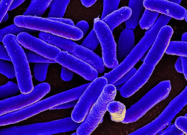  Escherichia coli, bactéria comum no homem que causa grandes estragos à saúde