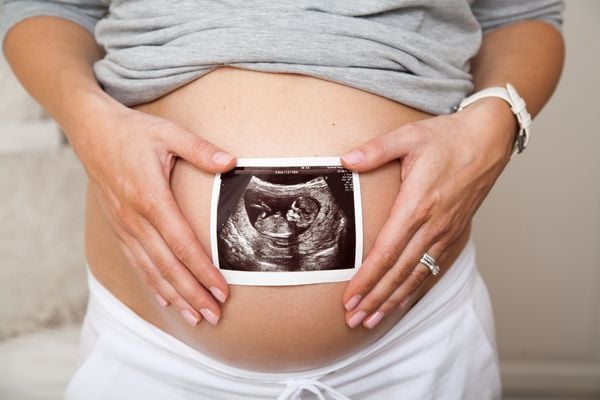 Mulher grávida segurando foto de ultrassonografia sobre a barriga