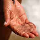 Imagem - Quiz da água-viva: faça o teste e saiba como agir se sofrer queimadura