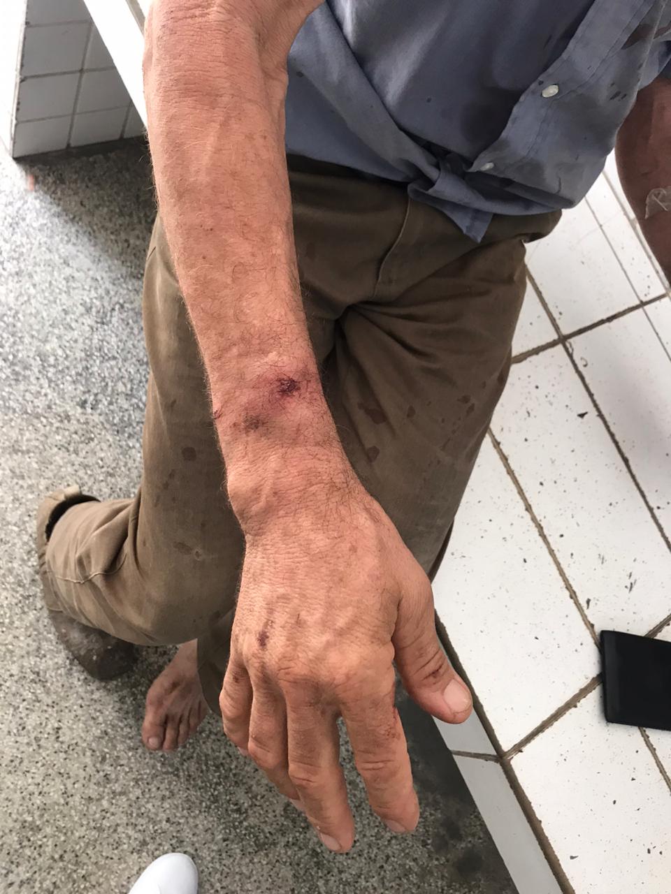 Sebastião ficou machucado após a abordagem dos policiais e precisou ser atendido em um hospital da Serra
