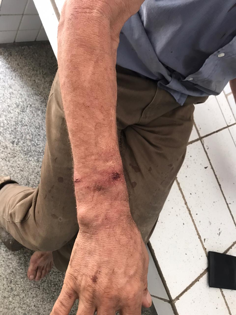 Sebastião ficou machucado após a abordagem dos policiais e precisou ser atendido em um hospital da Serra