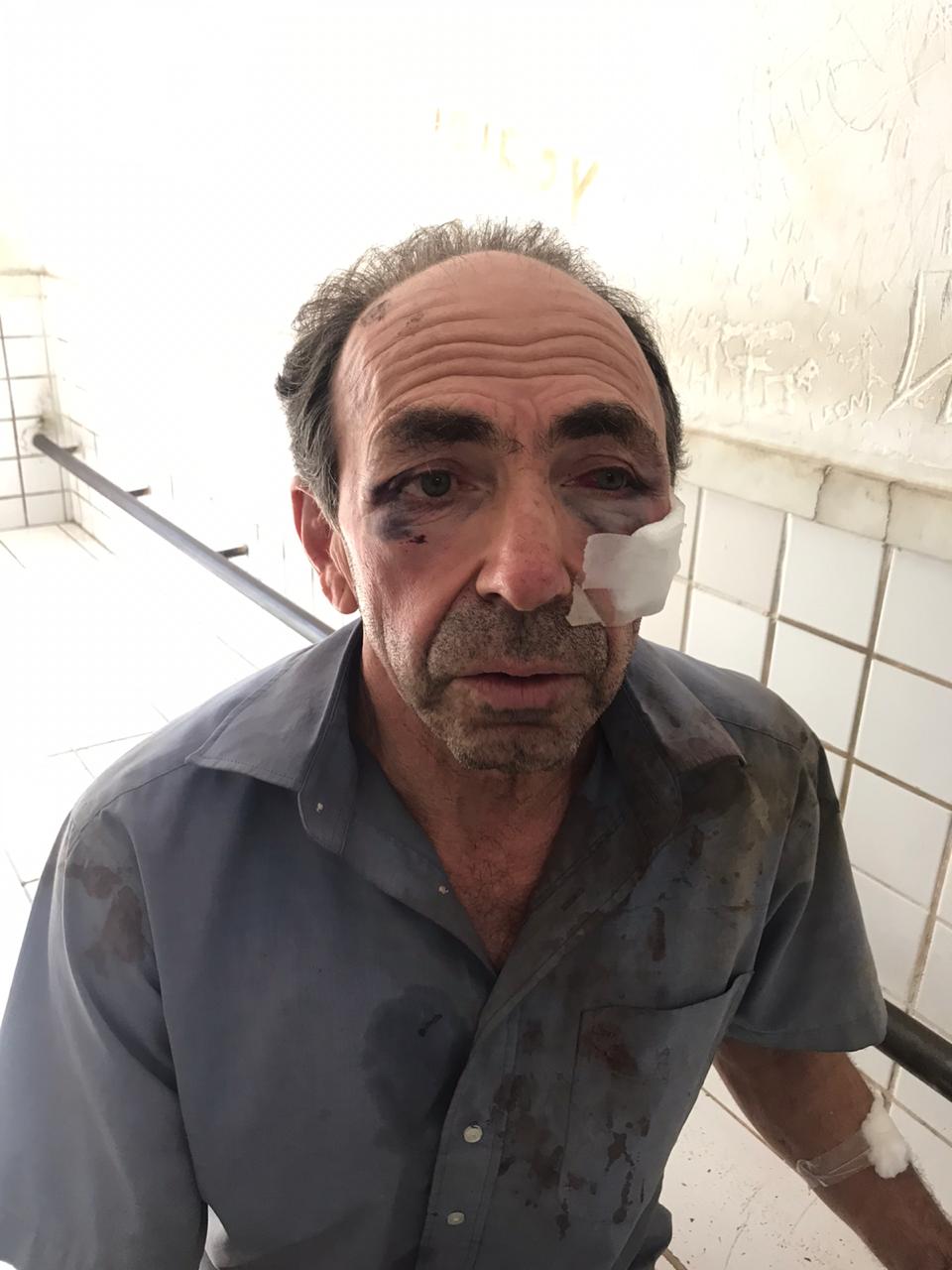 Sebastião ficou machucado após a abordagem dos policiais e precisou ser atendido em um hospital da Serra