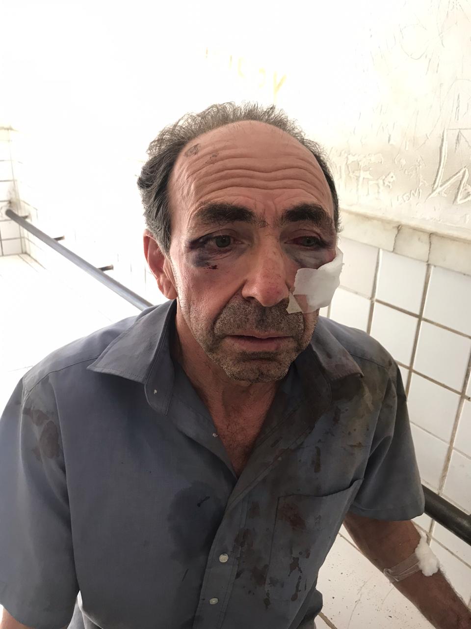 Sebastião ficou machucado após a abordagem dos policiais e precisou ser atendido em um hospital da Serra