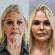 Imagem - Monique Evans é comparada à filha após harmonização facial em Vitória