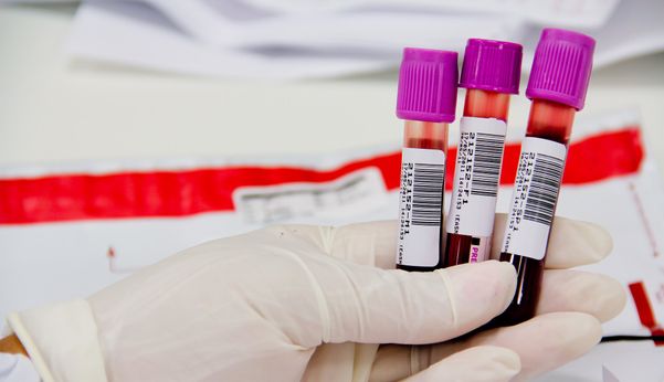 Exame de sangue: testes rápidos vão ser adquiridos pelo Estado para reduzir prazo de diagnóstico para o coronavírus. Crédito: Divulgação/ Ministério da Saúde