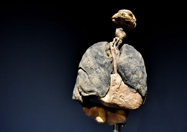 Museu de Ciências da Vida, da Ufes, apresenta corpo humano fatiado, após técnica de conservação chamada plastinação -Foto: Fernando Madeira - GZ por Fernando Madeira