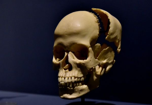 Museu de Ciências da Vida, da Ufes, apresenta corpo humano fatiado, após técnica de conservação chamada plastinação -  Foto: Fernando Madeira - GZ por Fernando Madeira