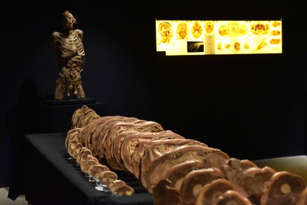 Museu de Ciências da Vida, da Ufes, apresenta corpo humano fatiado, após técnica de conservação chamada plastinação- Foto: Fernando Madeira - GZ por Fernando Madeira
