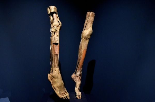 Museu de Ciências da Vida, da Ufes, apresenta corpo humano fatiado, após técnica de conservação chamada plastinação - Foto: Fernando Madeira - GZ por Fernando Madeira