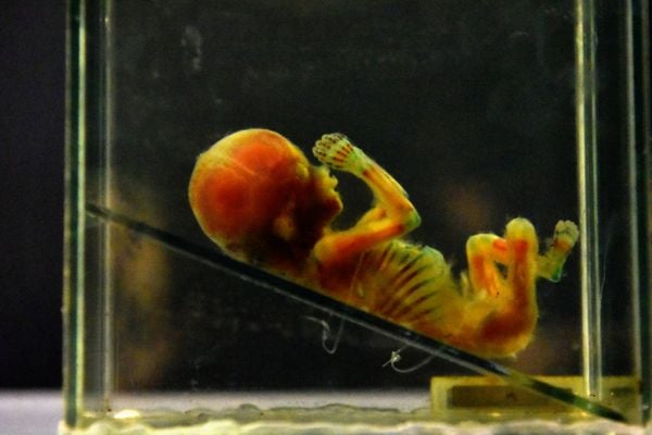 Museu de Ciências da Vida, da Ufes, apresenta corpo humano fatiado, após técnica de conservação chamada plastinação - Foto: Fernando Madeira - GZ por Fernando Madeira