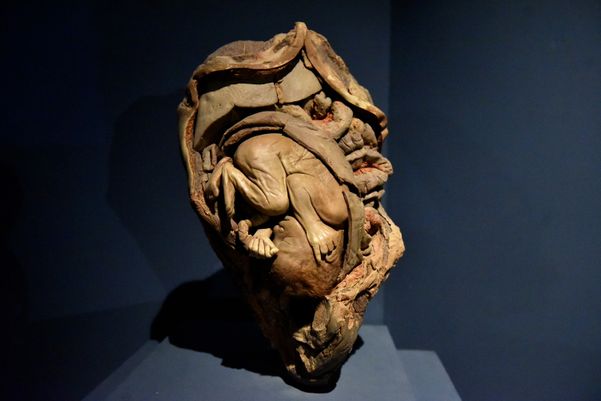 Museu de Ciências da Vida, da Ufes, apresenta corpo humano fatiado, após técnica de conservação chamada plastinação -  Foto: Fernando Madeira - GZ por Fernando Madeira