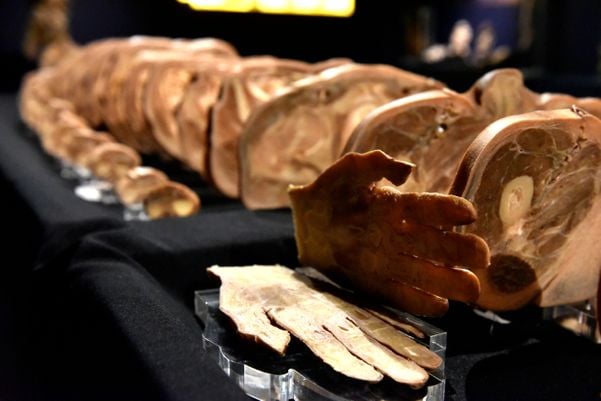 Museu de Ciências da Vida, da Ufes, apresenta corpo humano fatiado, após técnica de conservação chamada plastinação - Foto: Fernando Madeira - GZ por Fernando Madeira