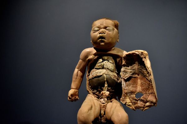 Museu de Ciências da Vida, da Ufes, apresenta corpo humano fatiado, após técnica de conservação chamada plastinação - Foto: Fernando Madeira - GZ por Fernando Madeira