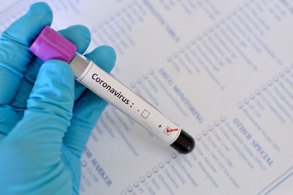 Coronavírus foi classificado pela OMS como pandemia. Crédito: Divulgação