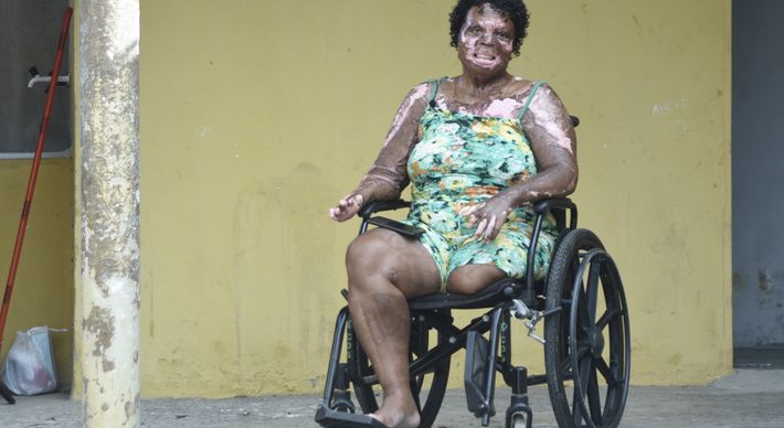 Na entrevista, Marciane narra como o ex-marido a queimou e faz um alerta às mulheres para que não passem pela mesma dor. Apesar de tudo, ela explica como conseguiu perdoá-lo, mas deixa claro que quer distância dele