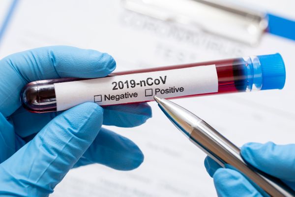 Data: 12/03/2020 - Profissional em laboratório realiza teste de coronavírus. Freepik