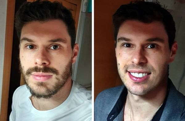 O jogador Bruno Rezende, o Bruninho, sem barba por Instagram/bruninho1