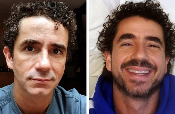 O jornalista Felipe Andreoli sem barba por Instagram/andreolifelipe