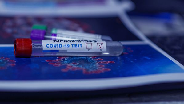 Além dos cuidados no dia a dia com as medidas sanitárias, companhias estão realizando testes rápidos e PCR para identificar possíveis focos de transmissão