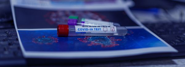 Teste para coronavírus