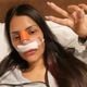 Imagem - Ex-BBB Flayslane mostra curativo e revela que fez cirurgia plástica