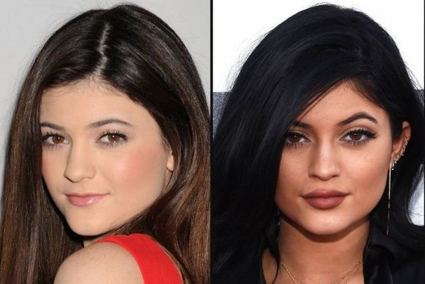 Protocolo Kardashians