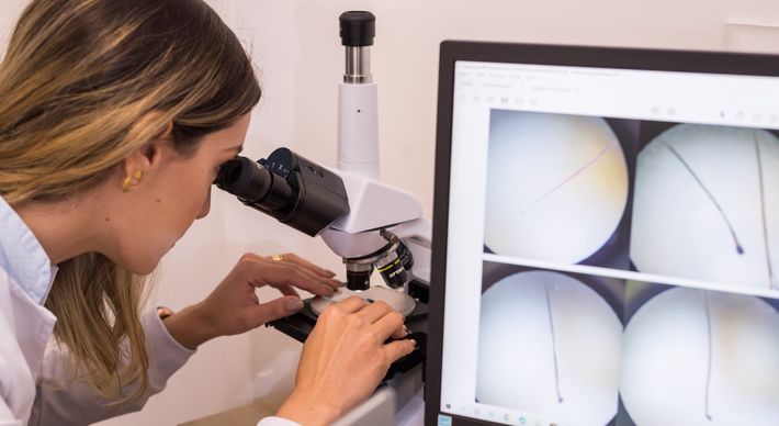 Recomendado por especialistas para quem sofre com a queda de cabelo, a microscopia de luz polarizada identifica as causas do problema e outras irregularidades no organismo por meio da análise do couro cabeludo