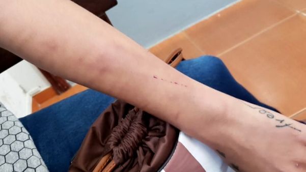 Fotos mostram o resultado das agressões no corpo da vítima: cortes, hematomas, arranhões e inchaços por Reprodução | TV Integração