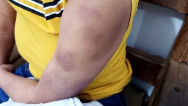 Fotos mostram o resultado das agressões no corpo da vítima: cortes, hematomas, arranhões e inchaços por Reprodução | TV Integração
