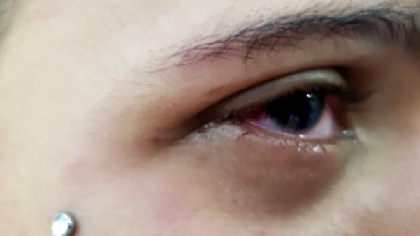 Fotos mostram o resultado das agressões no corpo da vítima: cortes, hematomas, arranhões e inchaços por Reprodução | TV Integração