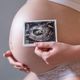 Imagem - De 25 países, Brasil é 2º com menor apoio ao aborto, diz pesquisa
