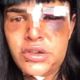 Imagem - Modelo trans do ES fica deformada após agressão e ameaças no Rio