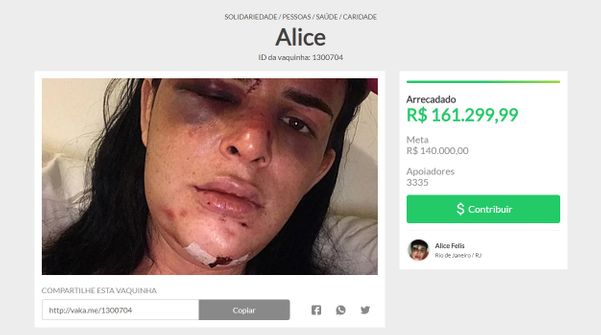 Modelo trans do ES deformada após agressão, Alice Felis arrecada R$ 161 mil em vaquinha virtual