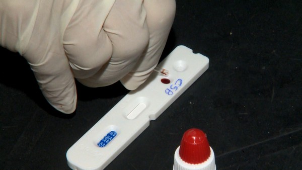 Especialistas explicam número alto de casos suspeitos de Covid-19 no Espírito Santo