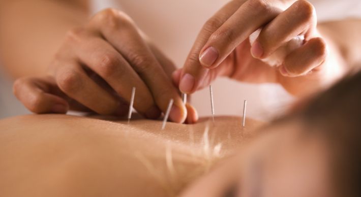 Estudos mostram que estimular alguns pontos de acupuntura ajudam a modular o cortisol no organismo, podendo chegar a mais de 25% de redução