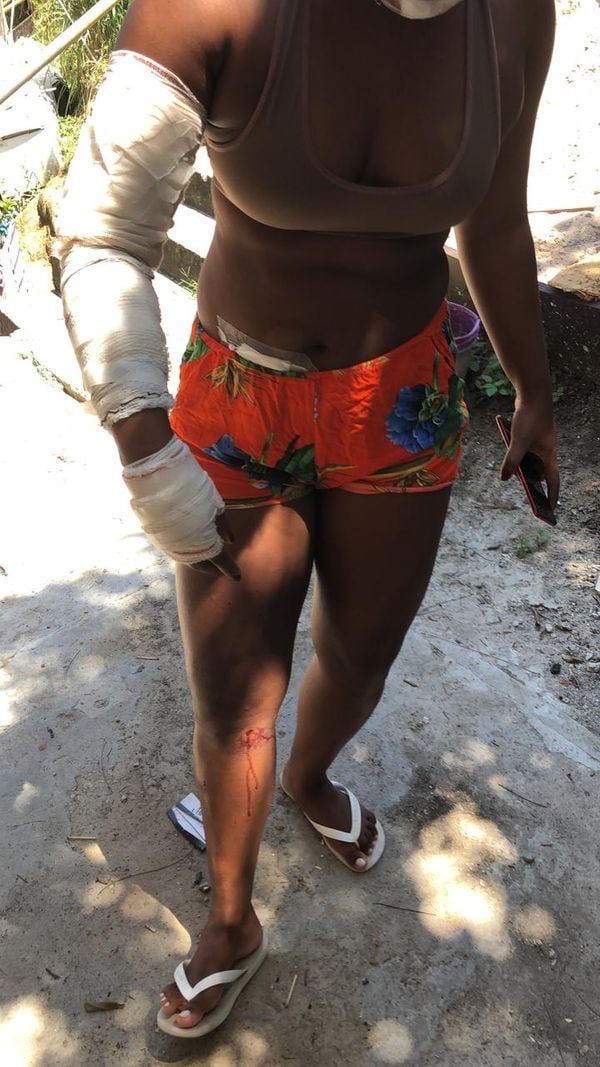 Moradora do Jaburu, Vitória, ferida pela PM