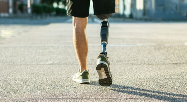 homem com perna amputada e prótese