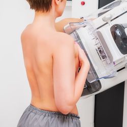 Senado aprova projetos que antecipam idade m&iacute;nima para mamografia no SUS |  A Gazeta