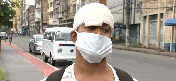 Silas Neves da Silva teve três cortes profundos na cabeça além de ferimentos no pescoço, no nariz e próximo ao olho