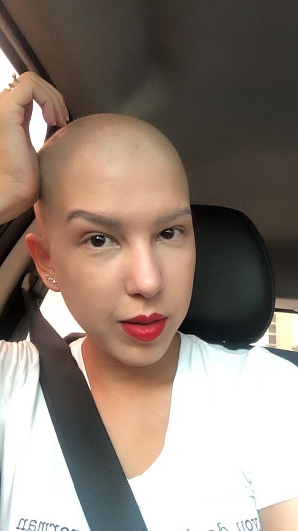 Adrieli Borsoe teve câncer de mama e cuidou dos cabelos