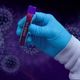 Pandemia do novo coronavírus: vacina vira disputa política