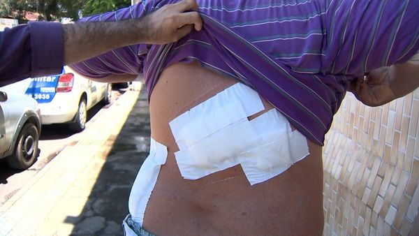 Jeferson Cabral Júnior mostrou os ferimentos feitos por faca durante assalto