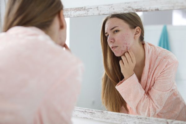 Mulher com acne se olhando no espelho
