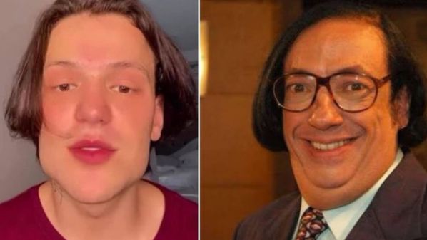 O próprio cantor chegou a brincar com a situação e negou ter se submetido a harmonização facial ou outro procedimento estético no rosto